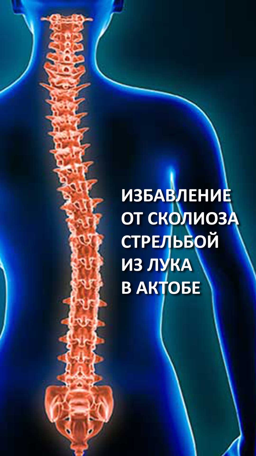 Лечение сколиоза в Актобе стрельбой из лука